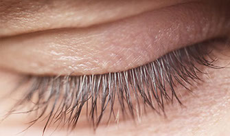 Emolienta, acerca de la piel, eczema palpebral